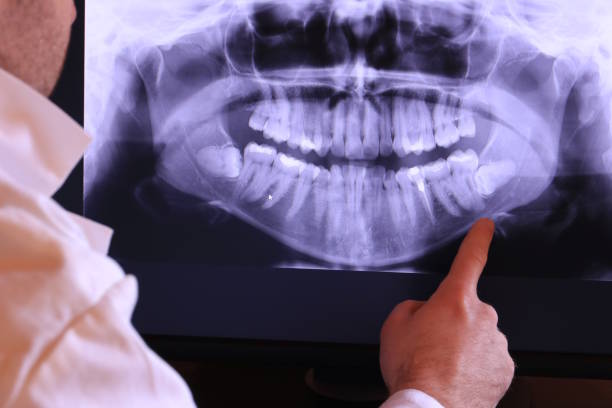 Best Emergency Tooth Extraction  in North Highlands, CA