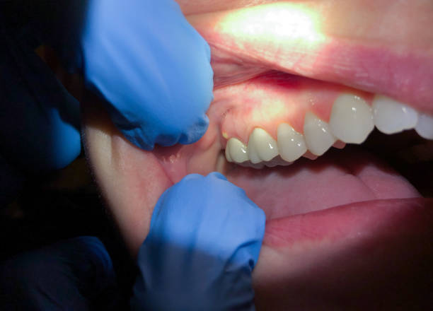 Best Dentist for Severe Toothache  in North Highlands, CA
