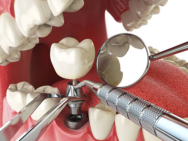 Best Broken Tooth Emergency  in North Highlands, CA