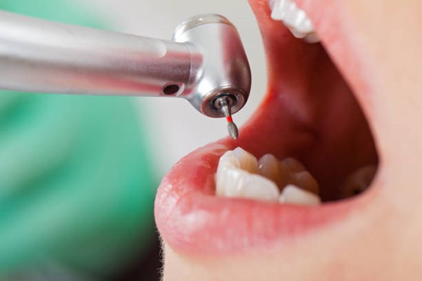 Best Emergency Gum Pain Relief  in North Highlands, CA